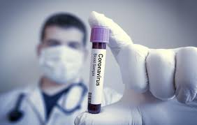  PANDEMIA: MT registra 37 mortes e mais de 4,2 mil casos no fim de semana