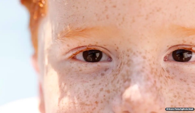 Campanha de conscientização sobre retinoblastoma começa hoje