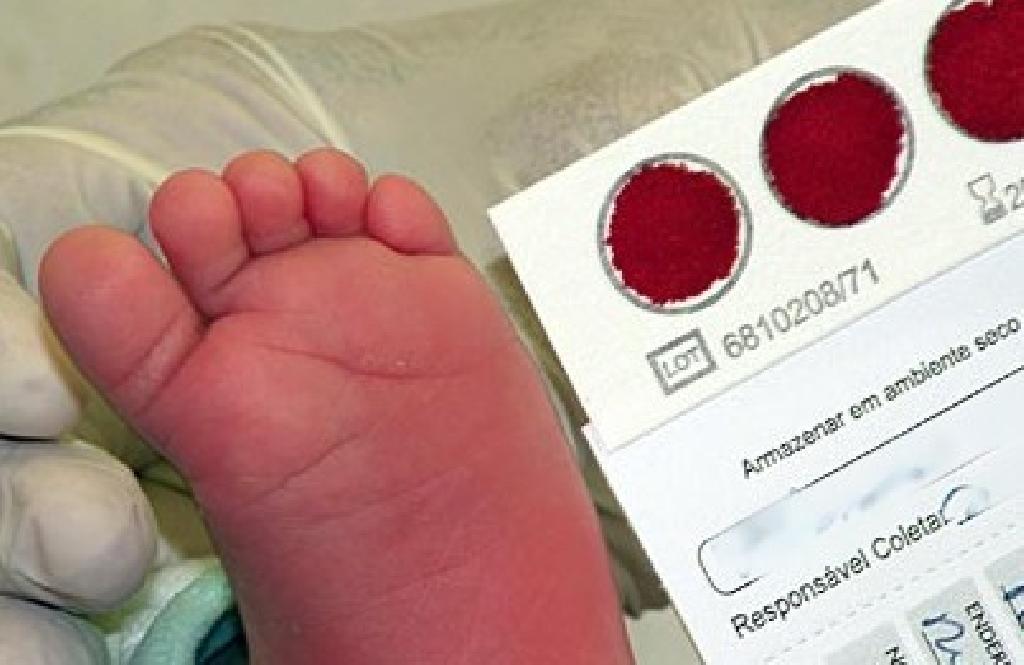 Dia Nacional do Teste do Pezinho reforça importância do diagnóstico precoce em recém-nascidos
