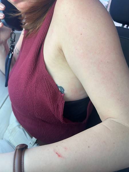 Paciente agride médica e técnica de enfermagem na UPA Morada do Ouro 