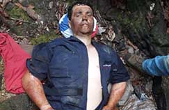   MILAGRES ACONTECEM: Piloto cujo avião caiu em mata fechada e pegou fogo, é encontrado vivo após 4 dias do acidente com sinais de queimaduras no rosto  e braços