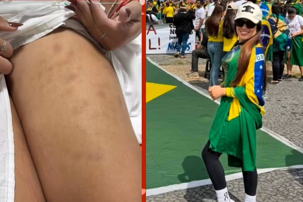 Empresária Nathalia Queiroz e a colega Ludmilla Fernanda foram atingidas por raio em ato em Brasília