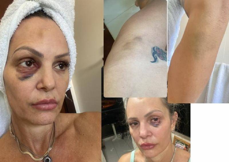 Juíza determina que policial civil use tornozeleira eletrônica 