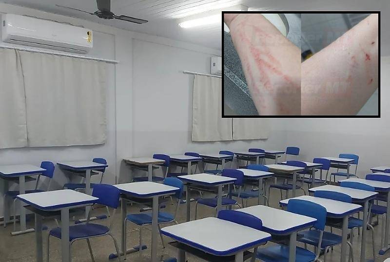 Aluno com Transtorno Espectro Autista agride professora em Escola de Várzea Grande