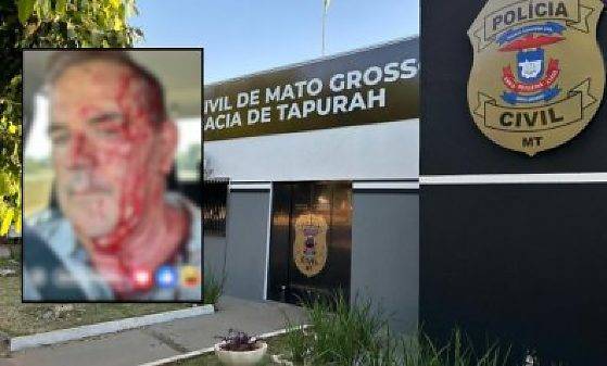 Ex-prefeito de Tapurah  leva garrafada na cabeça durante briga em família