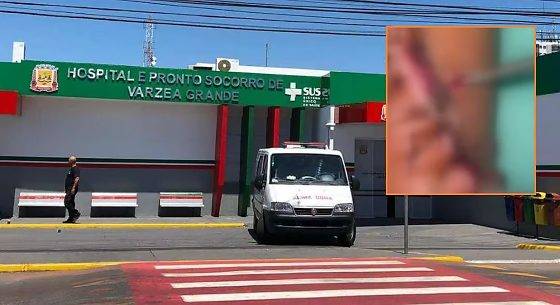 Paciente internado no Pronto-socorro de VG encontra larvas em ferimento 