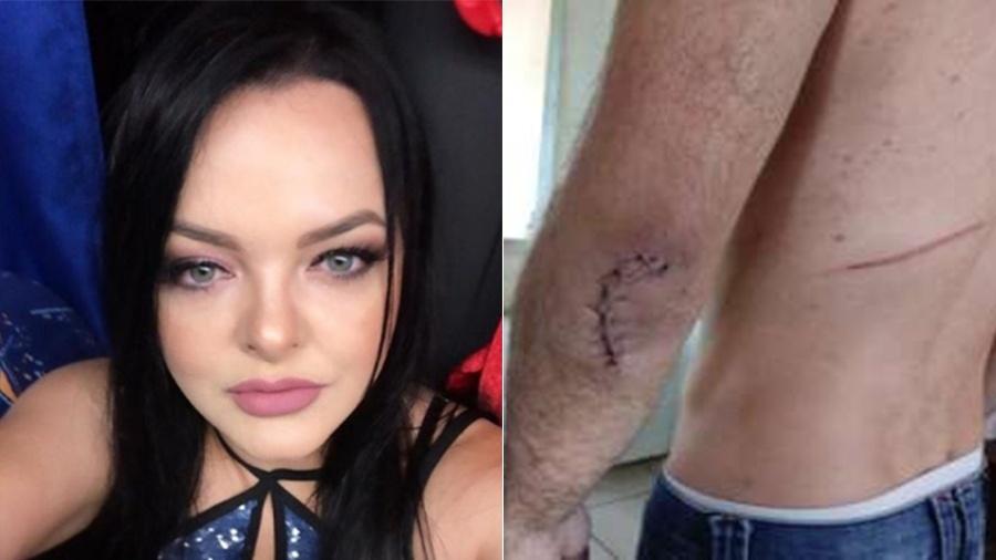 Cantora de dupla sertaneja que fez sucesso no MS é agredida pelo ex, e irmãos atropelam suspeito