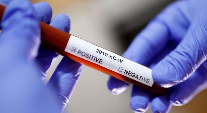 Mulher portadora de diabetes é o segundo caso confirmado de coronavírus em MT