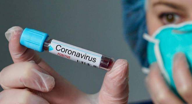 Brasil registra recorde de 26,7 mil novos casos de coronavírus em 24 horas