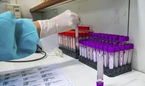 DISSEMINAÇÃO EM ALTA: EUA registra novo recorde com mais de 180 mil infecções diárias por coronavírus