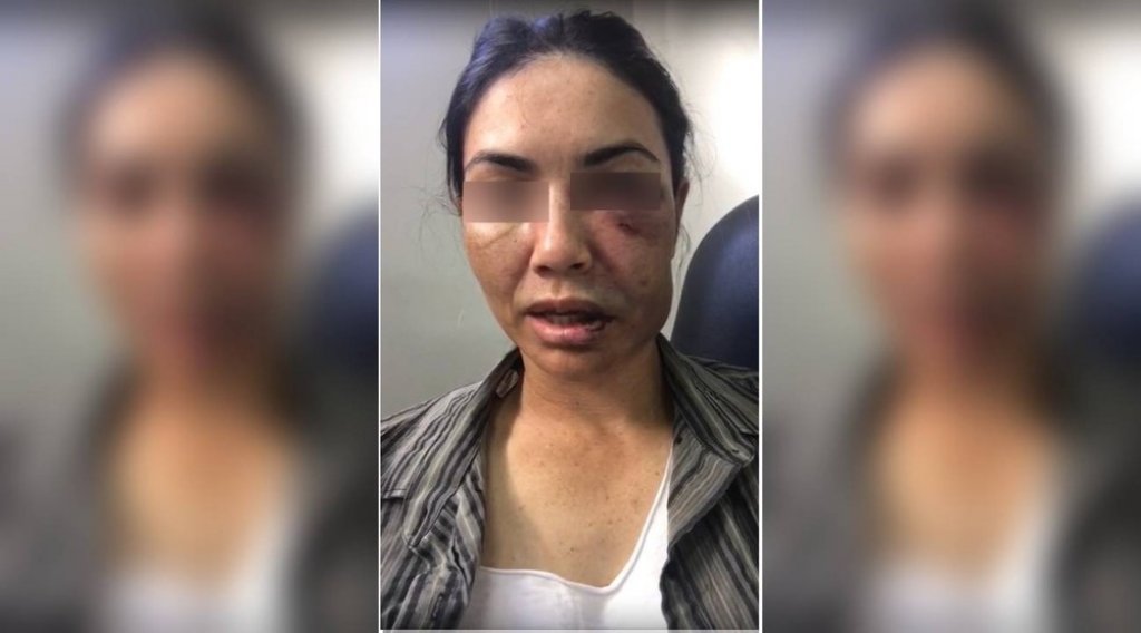 MOTORISTA DE APLICATIVO: Mulher é barbarizada por assaltantes, fingiu estar morta e foi jogada de ponte em rio